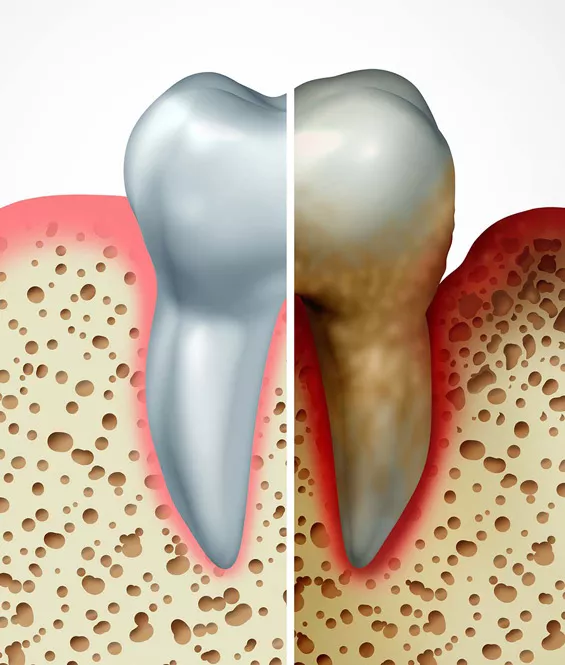 periodontics